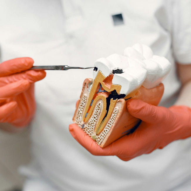 Zahnärztliche Chirurgie in der Zahnarztpraxis Lotus Dent