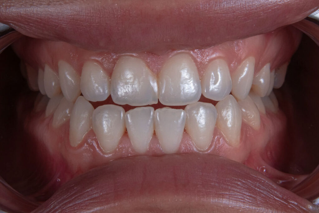 Zahnmedizin bei LotusDent in Ingolstadt